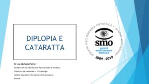 Diplopia e Cataratta