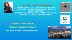 Correzione chirurgica dello Strabismo Divergente Exotropia